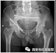 微信图片_20190319214510.jpg
