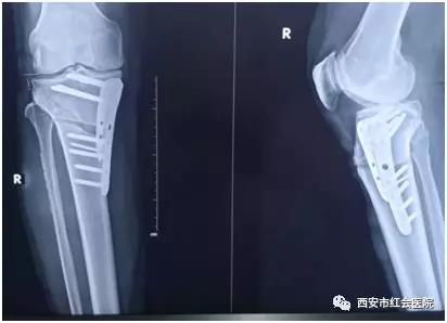 微信图片_20191126161555.jpg 微信图片_20191126161555.jpg