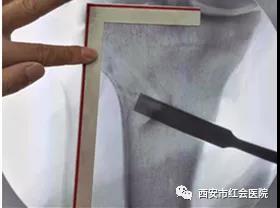 微信图片_20191126161558.jpg 微信图片_20191126161558.jpg