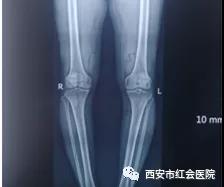 微信图片_20191126161553.jpg 微信图片_20191126161553.jpg