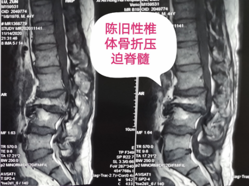 20201126_144346_136.png