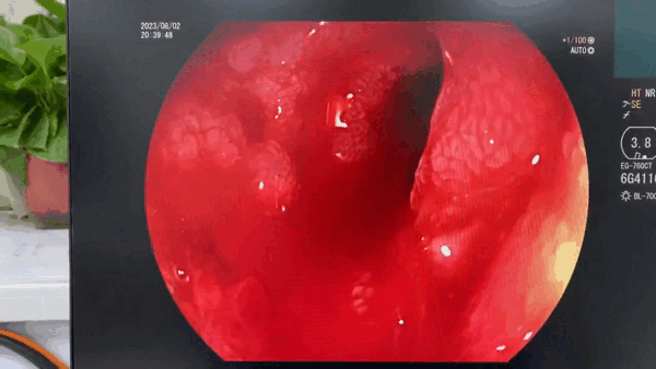 1.gif