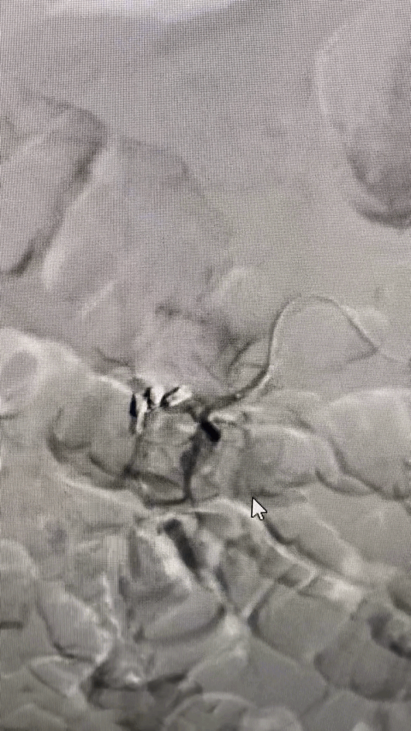 2.gif