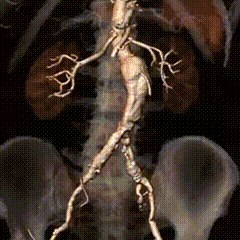 [6]图片.gif