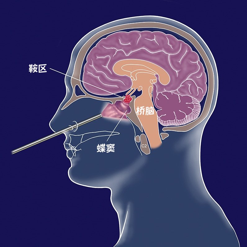 [11]图片.png