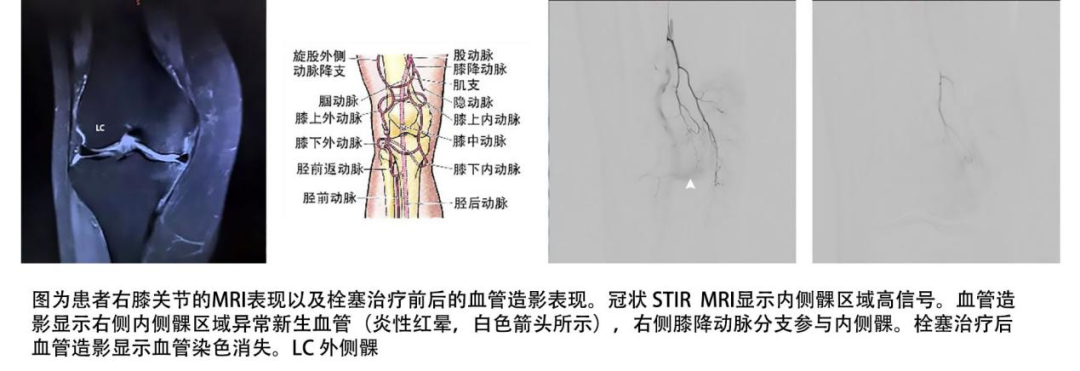 [4]图片.png