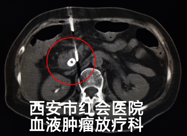 [6]图片.png