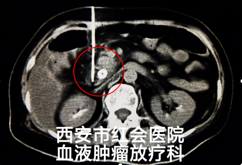 [7]图片.png