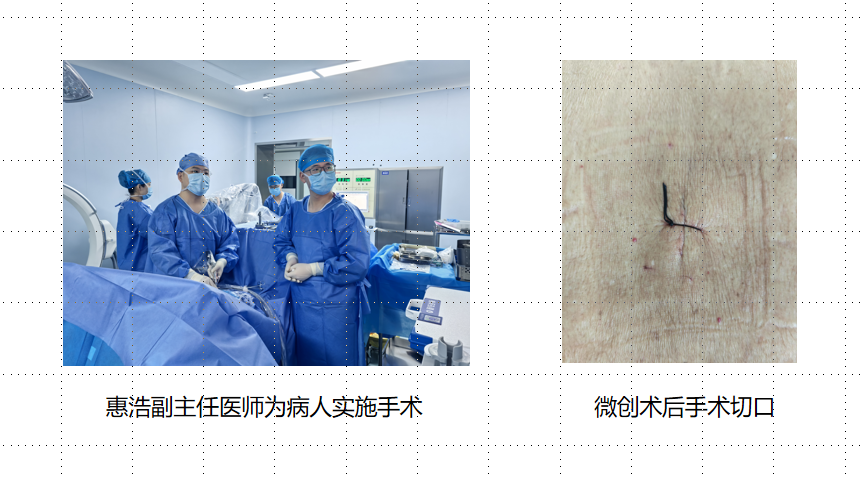 [4]图片.png