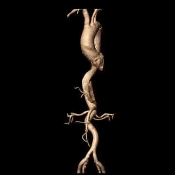 [4]图片.gif