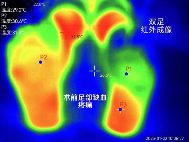 [6]图片2.png.png