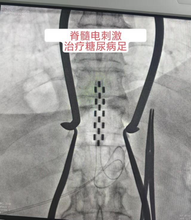 [8]图片4.png.png