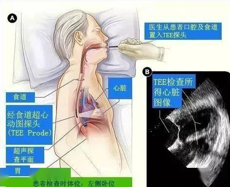 [9]图片1.png.png