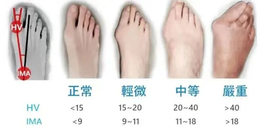 [4]图片 1.png.png