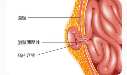 [4]图片.png