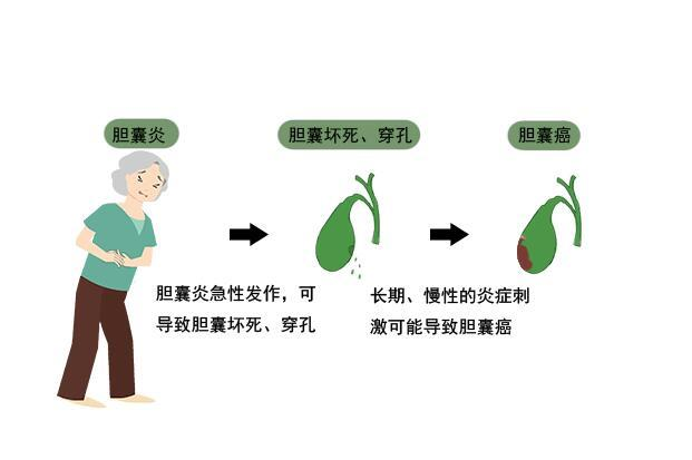[4]图片.png