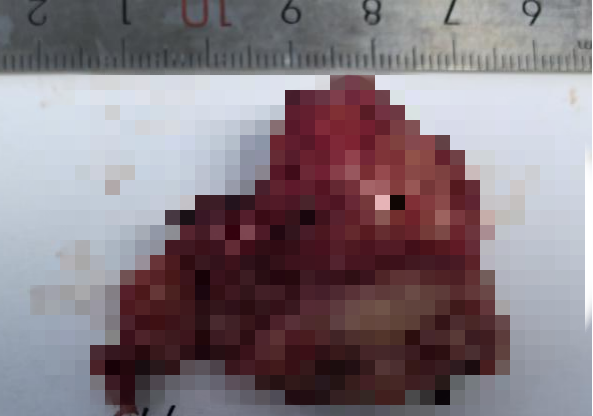 [4]图片.png