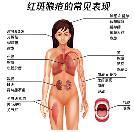 [4]图片.png