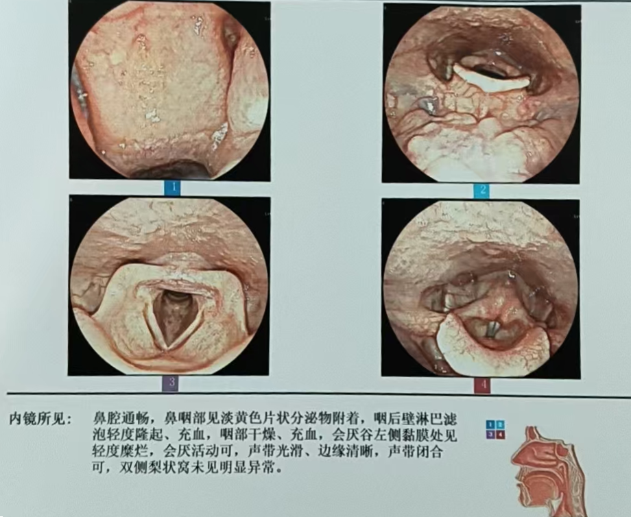 [3]图片.png