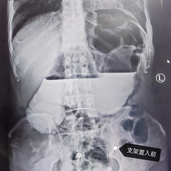 [6]图片 5.png.png