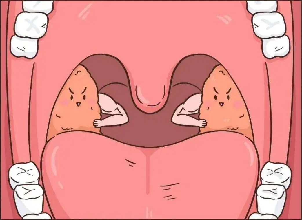 33.png