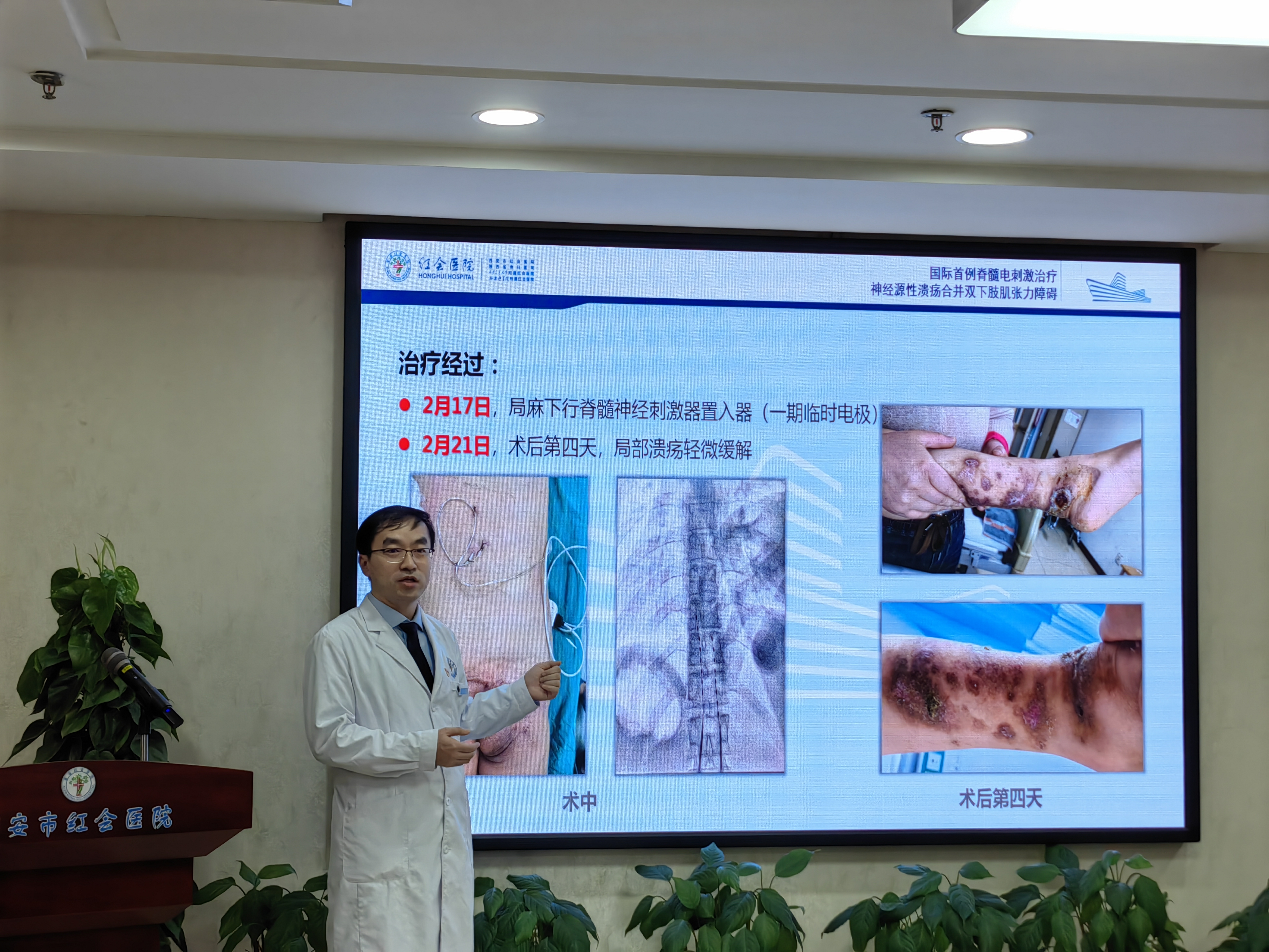 西安市红会医院成功应用神经调控技术为患者带来新生_fororder_图片1