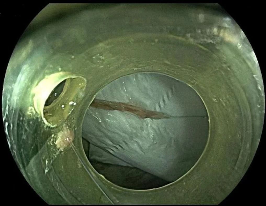 34726ef6e42c9a3fcce6f614403e46c8