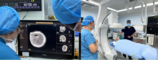 术中导航:C臂CT三维成像锁定穿刺路径