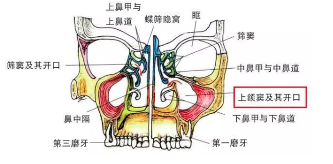 12_牙齿种植怎么做上颌窦提升术-爱康健齿科.png