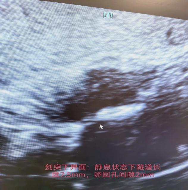 [4]图片6.png.png