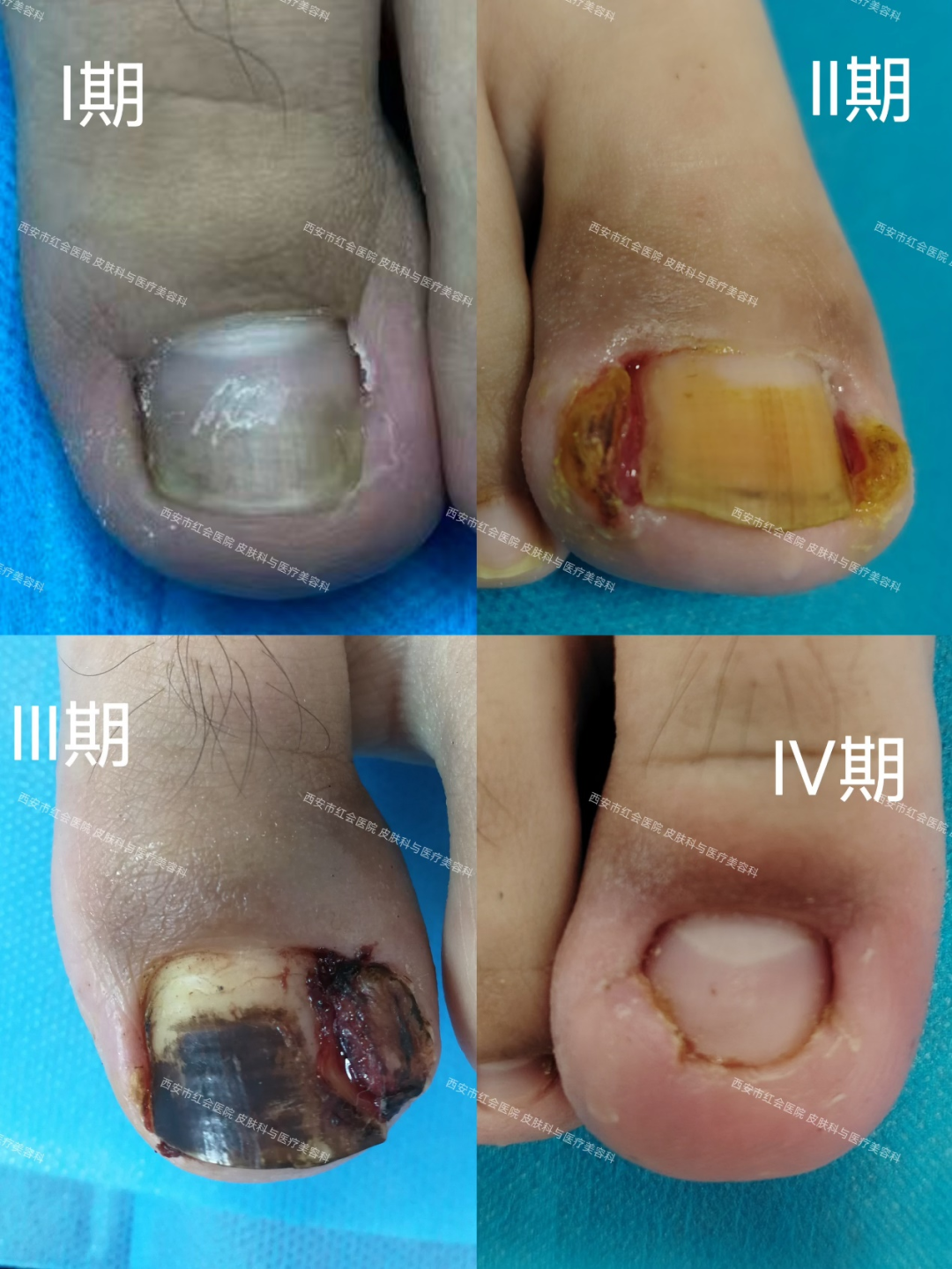 10_图片12.png.png 10_图片12.png.png