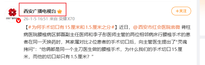 Snipaste_2026-02-26_15-23-54.png Snipaste_2026-02-26_15-23-54.png