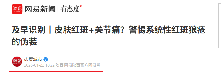 Snipaste_2026-02-27_10-11-10.png Snipaste_2026-02-27_10-11-10.png