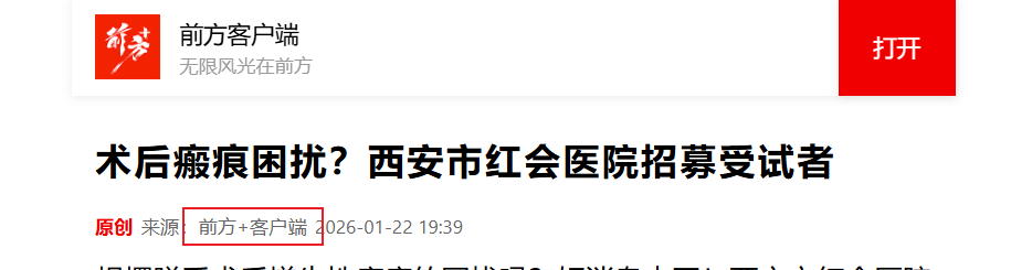 Snipaste_2026-02-27_11-09-44.png Snipaste_2026-02-27_11-09-44.png