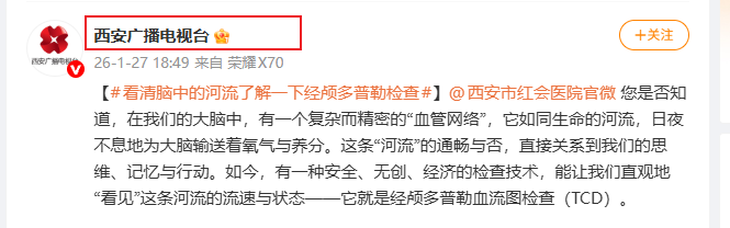 Snipaste_2026-02-27_16-27-28.png Snipaste_2026-02-27_16-27-28.png