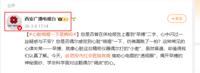 Snipaste_2026-03-31_11-22-21.png Snipaste_2026-03-31_11-22-21.png