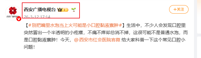 Snipaste_2026-04-09_15-09-23.png Snipaste_2026-04-09_15-09-23.png