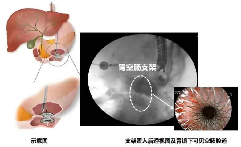 图片 1.png 图片 1.png