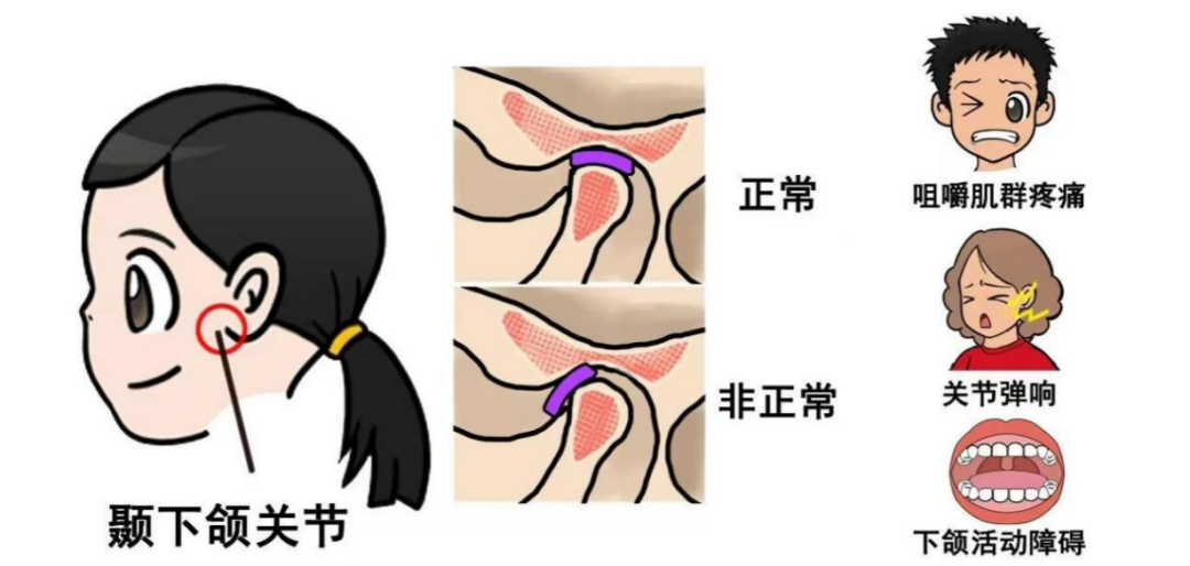 22.png